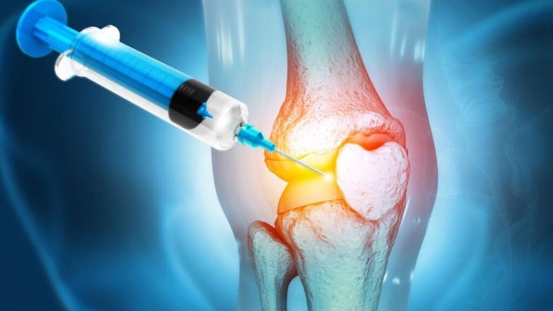 Chi phí tiêm dịch nhờn khớp gối phụ thuộc vào loại thuốc và liệu trình điều trị