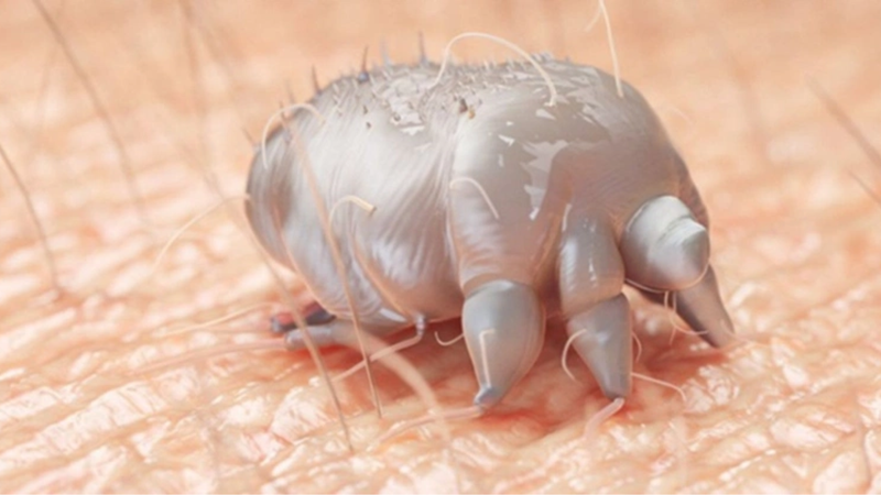 Thuốc trị ghẻ nước nào an toàn và hiệu quả? 1