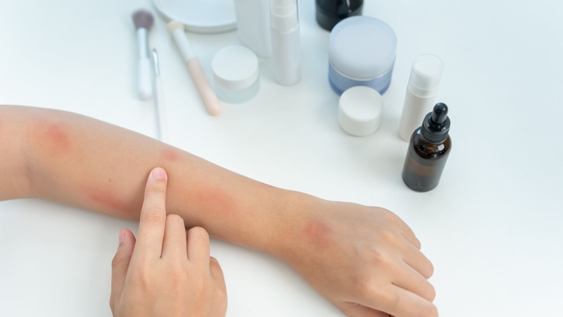 Thuốc bôi là nhóm thuốc được sử dụng trực tiếp lên da để tiêu diệt ký sinh trùng tại chỗ