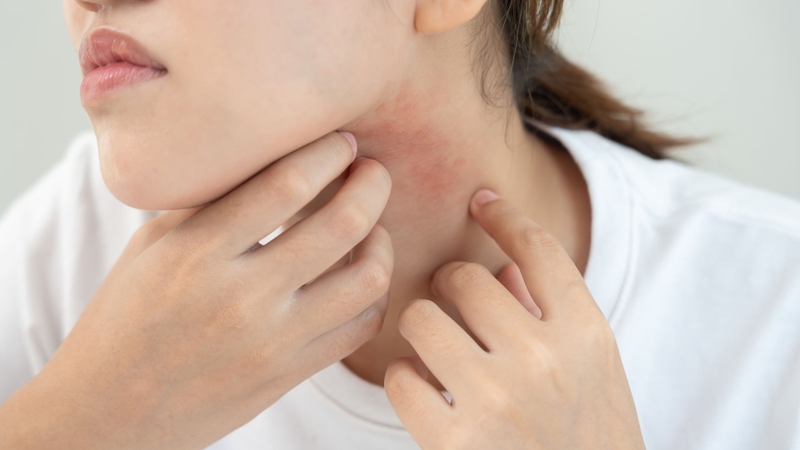 Điều kiện vệ sinh kém là yếu tố thuận lợi cho ký sinh trùng sinh sống và phát triển