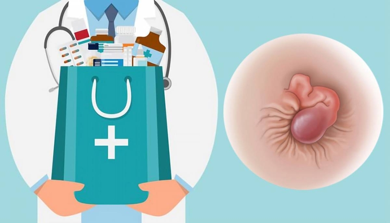 Thuốc trĩ là gì? Công dụng của thuốc trĩ trong điều trị bệnh trĩ 2