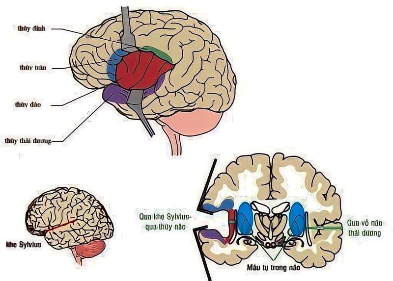 Thùy đảo là gì? Cấu trúc và chức năng của thùy đảo đối với con người 2