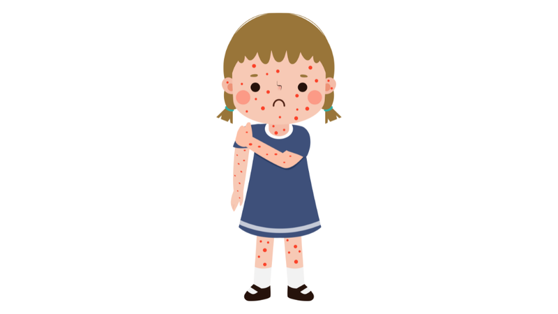 thuy-dau-noi-nhieu-o-mat-tre-co-nguy-hiem-khong 2