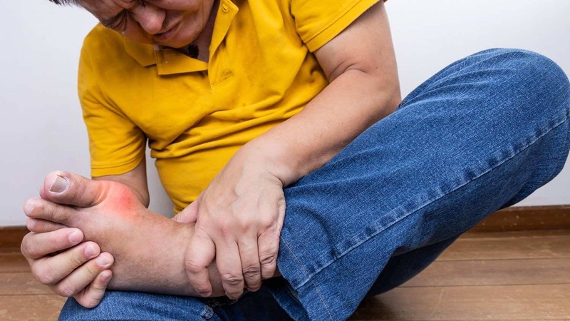 Bốn hoạt chất trong lá tía tô giúp cải thiện tình trạng bệnh gout