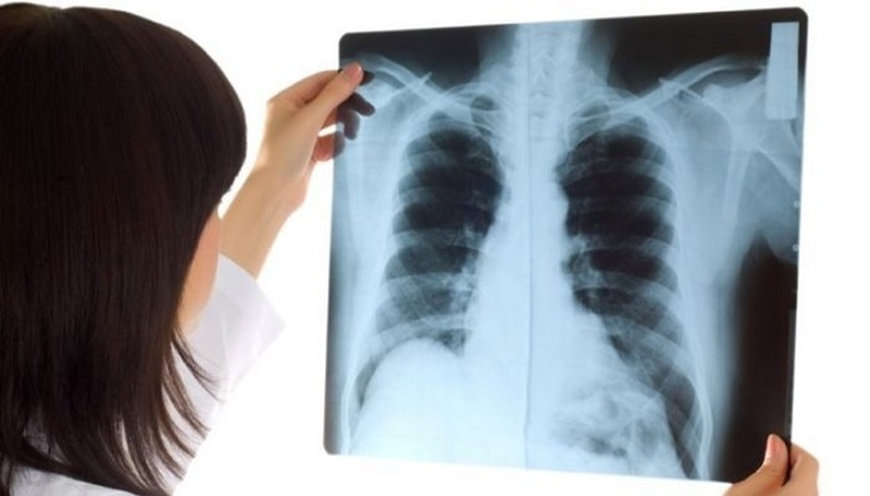 Tia X là gì? Tìm hiểu về chụp X - quang3