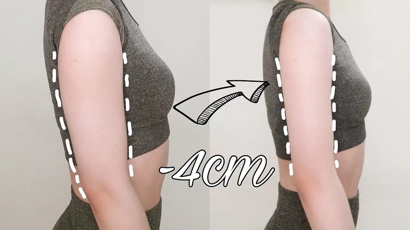 Tiêm botox bắp tay - Phương pháp thẩm mỹ không xâm lấn 2