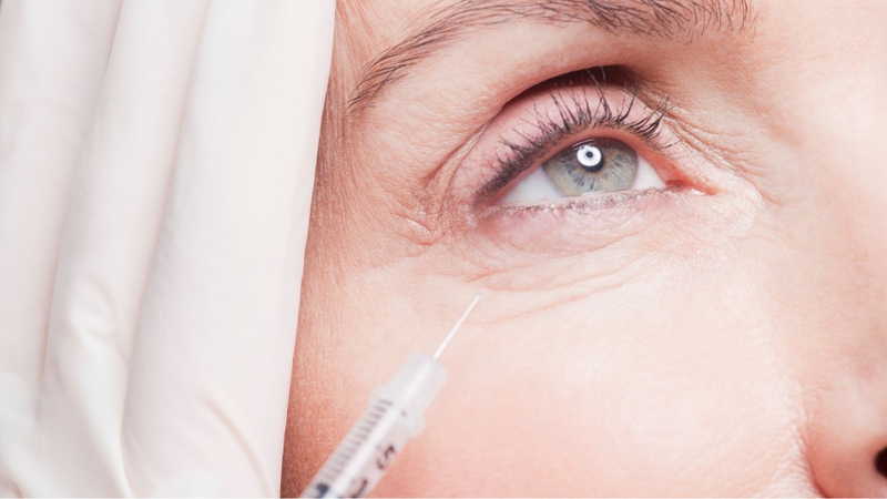Người có làn da chảy xệ cân nhắc tiêm botox