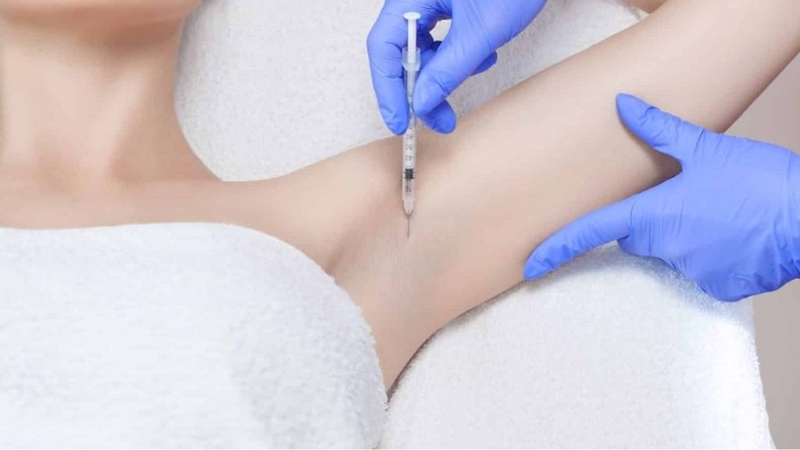 Tiêm botox trị hôi nách và những điều cần biết 2
