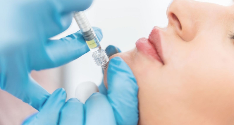 Tiêm filler cằm kiêng gì tốt nhất 1