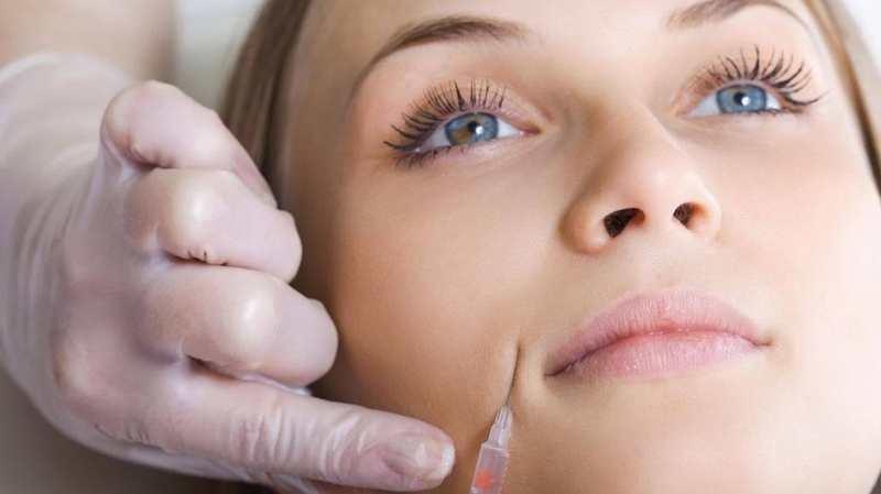 Tiêm filler rãnh cười bị sưng có nguy hiểm không?3
