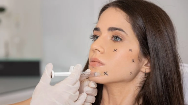 Tiêm Jalupro: Phương pháp làm đẹp hỗ trợ trẻ hóa tự nhiên cho da 4