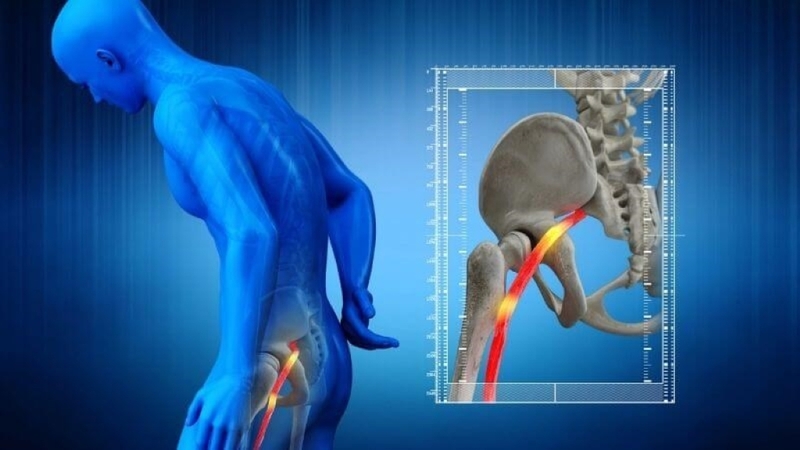 Tiêm mông ở vị trí nào là an toàn? 6