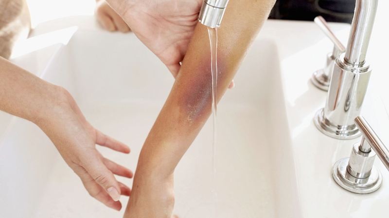 Tiêm ngừa chó cắn ở đâu Cần Thơ? 1