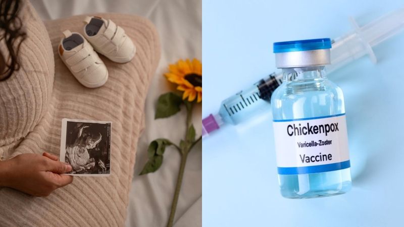Tiêm ngừa thủy đậu khi mang thai được không là nỗi băn khoăn của nhiều mẹ bầu