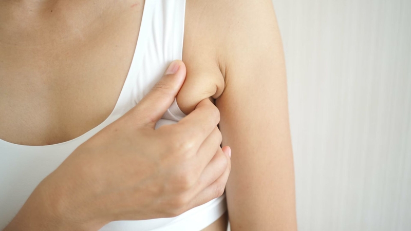 Tiêm tan mỡ nách: Những điều cần biết trước khi thực hiện 4