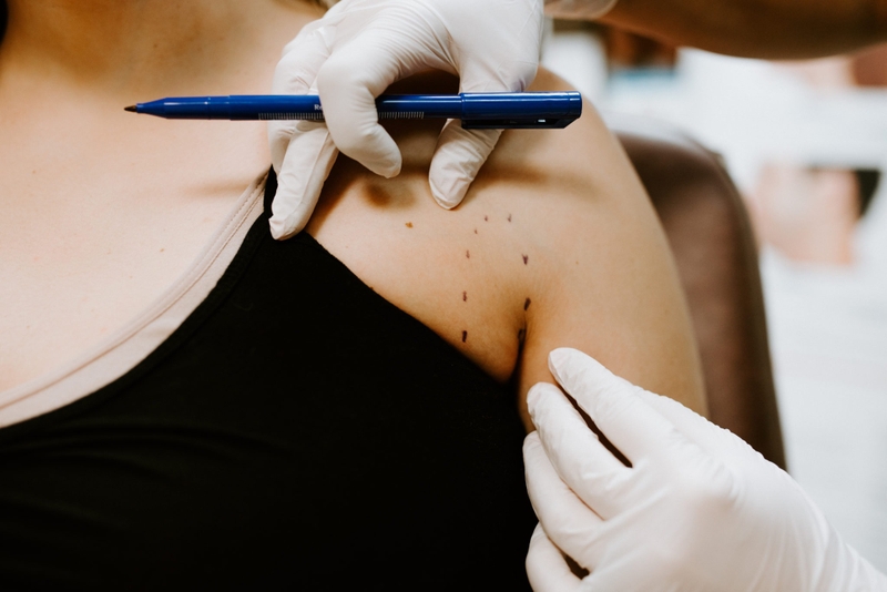 Tiêm tan mỡ nách: Những điều cần biết trước khi thực hiện 4