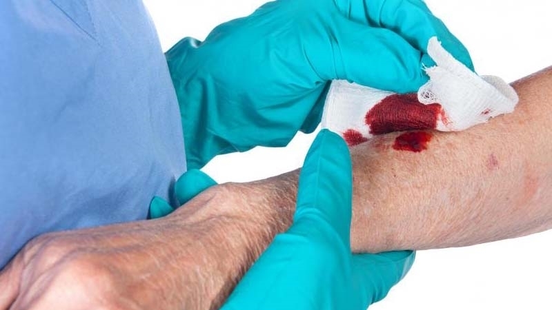 Tiêm uốn ván để làm gì? Lợi ích của việc tiêm uốn ván với các vết thương ngoài da? 1