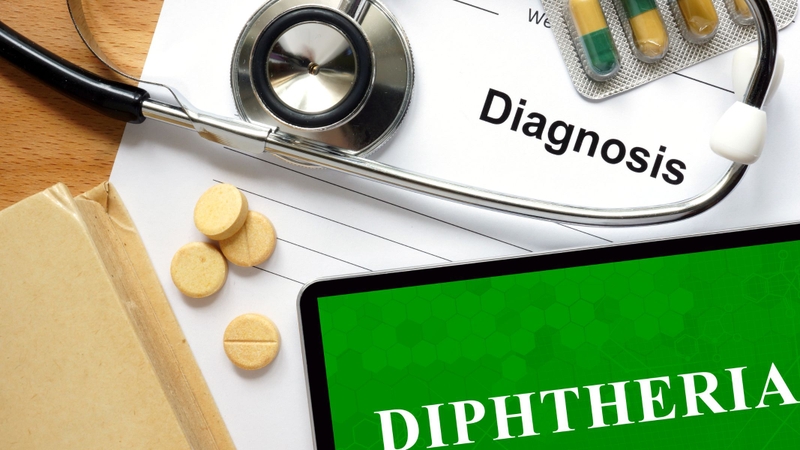 Bạch hầu là bệnh nhiễm khuẩn cấp tính lây truyền qua đường hô hấp