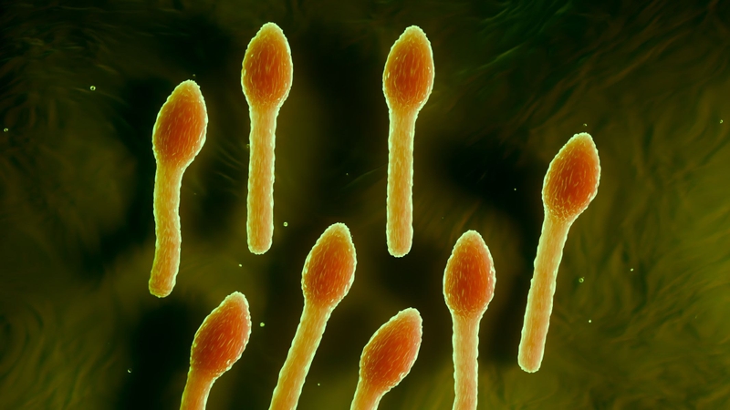 Uốn ván do vi khuẩn Clostridium tetani xâm nhập qua vết thương hở, sinh độc tố gây co cứng cơ, khóa hàm, suy hô hấp