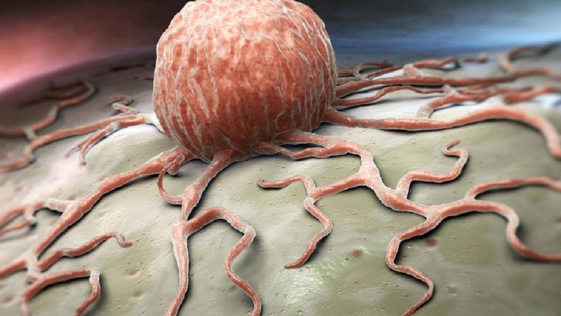 Tiên lượng là gì? Điều cần biết về tiên lượng 3