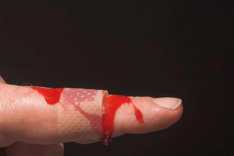 Tiểu cầu giảm bao nhiêu là nguy hiểm? Lưu ý gì để tránh biến chứng 2