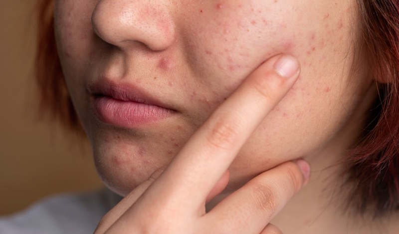 Tiêu chí chọn mua và review dầu tẩy trang cho da dầu mụn 1