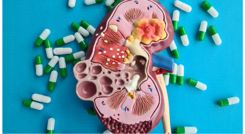 Tiểu chuẩn chẩn đoán bệnh thận mạn 4