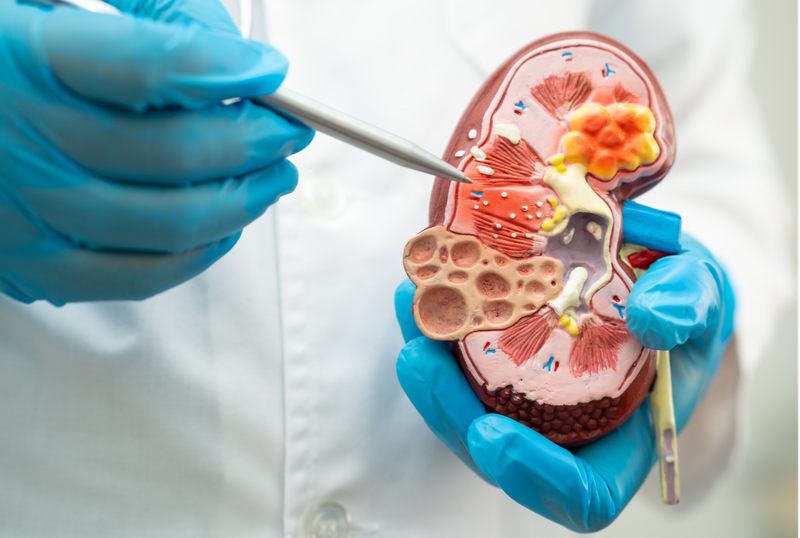 Tiểu chuẩn chẩn đoán bệnh thận mạn 1