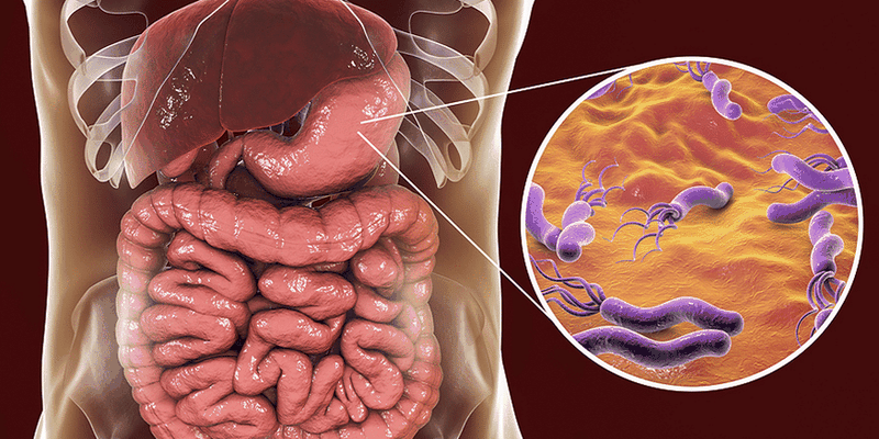 Bật mí cách tiêu diệt vi khuẩn HP tận gốc 1