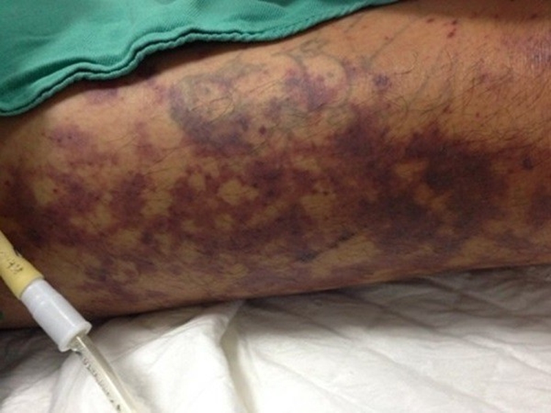 Món tiết canh có để tủ lạnh được không?-2