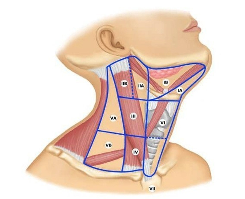 Tìm hiểu các nhóm hạch đầu mặt cổ: 6 nhóm hạch cổ2
