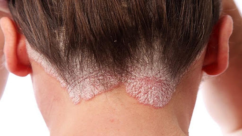 tim-hieu-cach-su-dung-thuoc-uon-toc-dung-quy-chuan-an-toan-hieu-qua 4