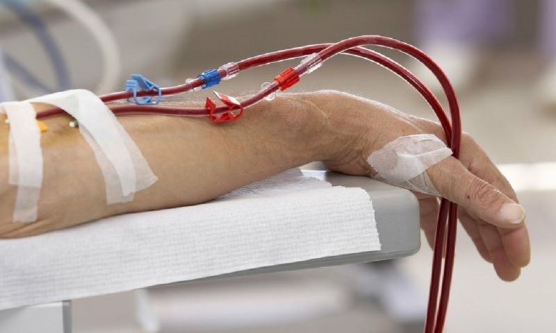 Tìm hiểu cầu tay chạy thận là gì? Quy trình thực hiện phương pháp cầu tay chạy thận 2