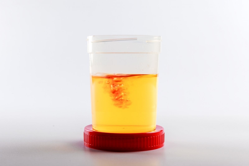 Tìm hiểu cây cỏ mực có tác dụng gì 3