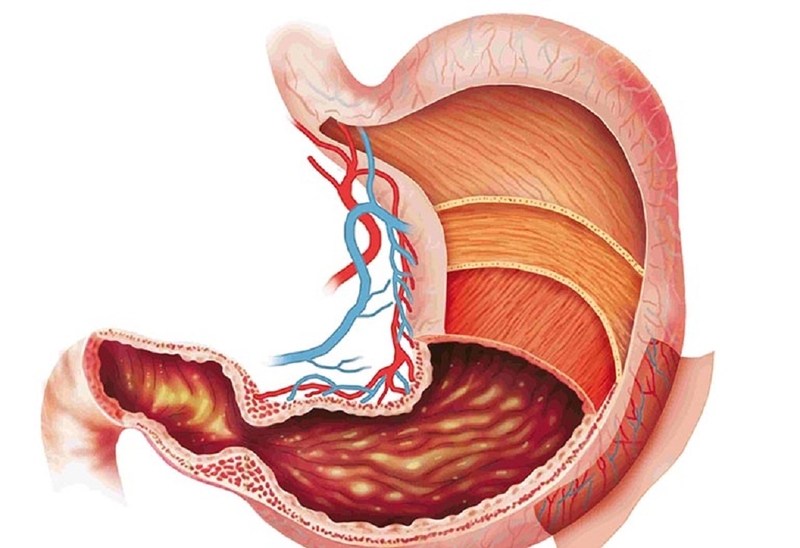 Tìm hiểu dạ dày có mấy lớp? Cấu tạo và chức năng quan trọng của dạ dày 2