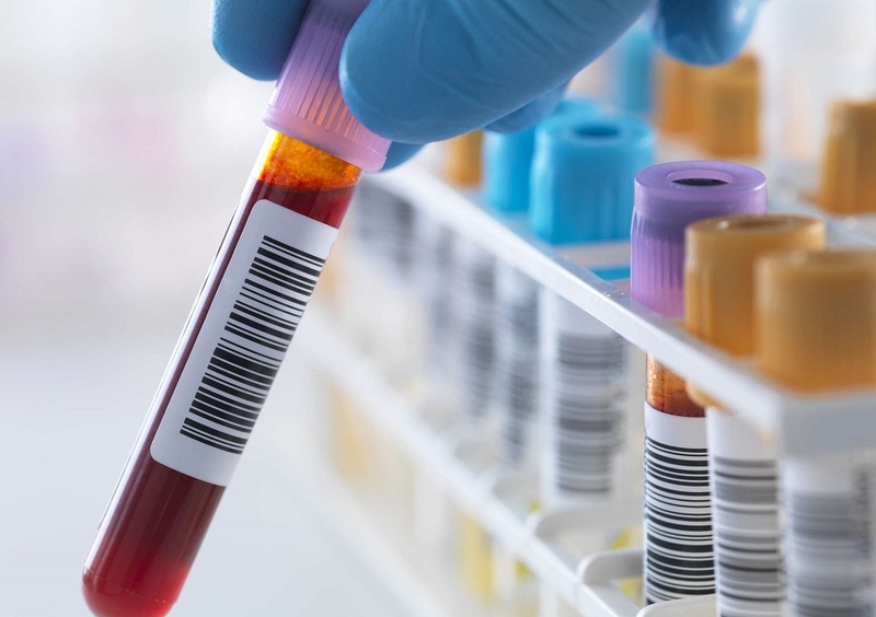 Tìm hiểu định lượng MPO là gì? Nguyên lý định lượng MPO như thế nào? 4