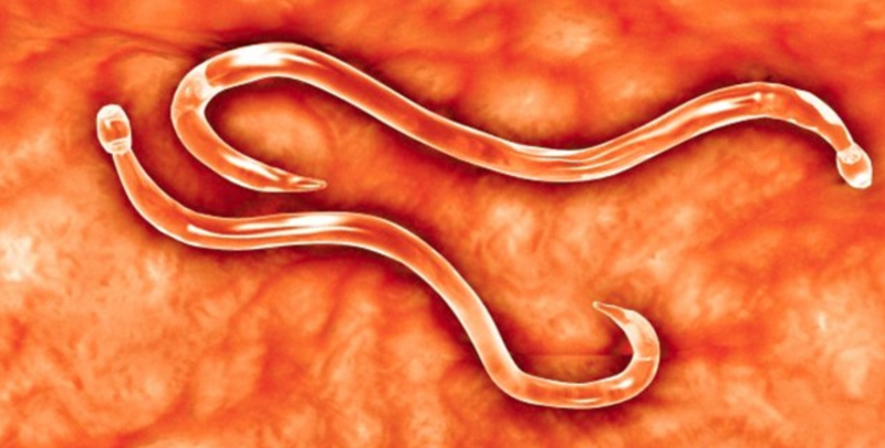 Tìm hiểu giun móc câu kí sinh ở đâu ? 1