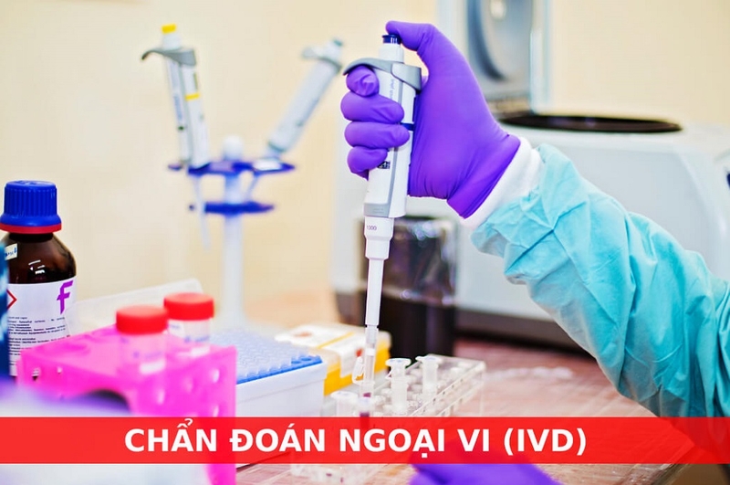 Tìm hiểu IVD là gì? Phân loại các dạng IVD phổ biến mà bạn cần biết 2