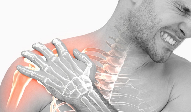 Tìm hiểu ngay viêm quanh khớp vai uống gì để cải thiện tình trạng bệnh 1