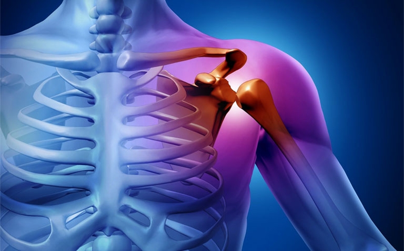 Tìm hiểu ngay viêm quanh khớp vai uống gì để cải thiện tình trạng bệnh 2