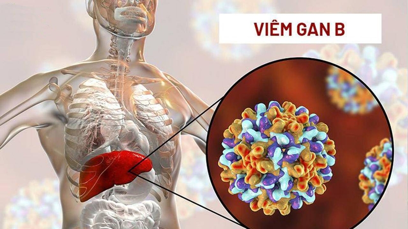 Tìm hiểu người lành mang virus viêm gan b có lây không? 4