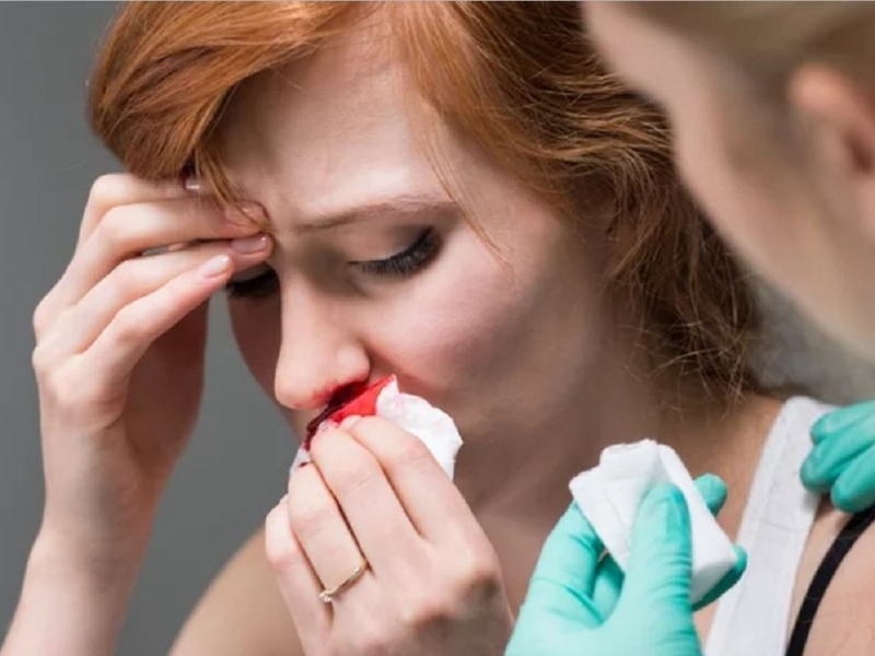Tìm hiểu nguyên nhân và cách xử lý tình trạng bà bầu bị chảy máu mũi 2
