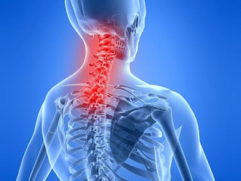 Tìm hiểu nguyên nhân và phương pháp điều trị các bất thường khớp nối sọ-cổ 2