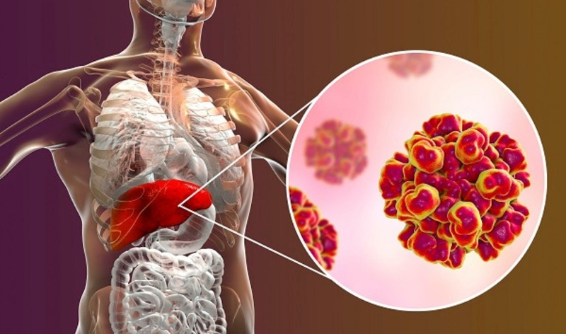 Tìm hiểu phác đồ điều trị viêm gan C  hiện nay 1