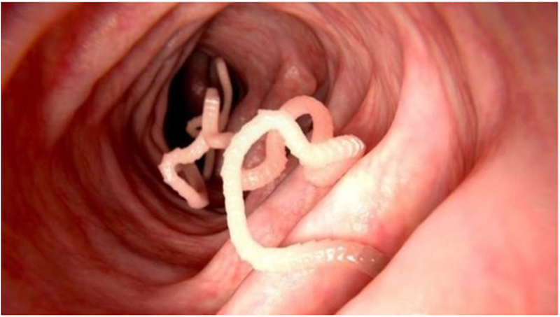 Tìm hiểu tác hại của giun đũa kí sinh trên cơ thể 1