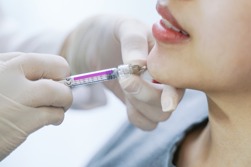 Tìm hiểu tiêm filler cằm có ảnh hưởng gì không 2