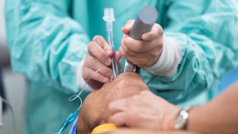 Tìm hiểu tổng quan về kỹ thuật mở cơ đường miệng 2