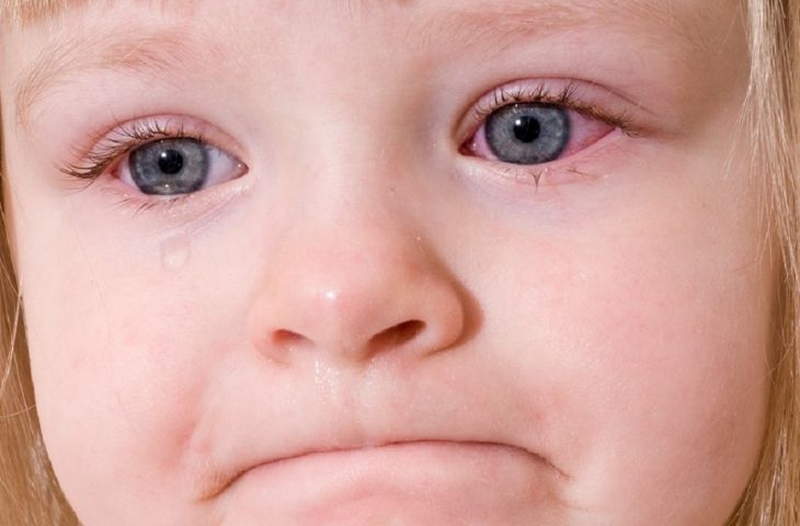 Tìm hiểu về adenovirus ở trẻ em2