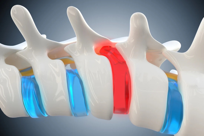 Tìm hiểu về các phương pháp vật lý trị liệu phổ biến nhất hiện nay 2