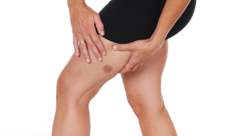 Tìm hiểu về cơ Hamstring và một số chấn thương thường gặp 2